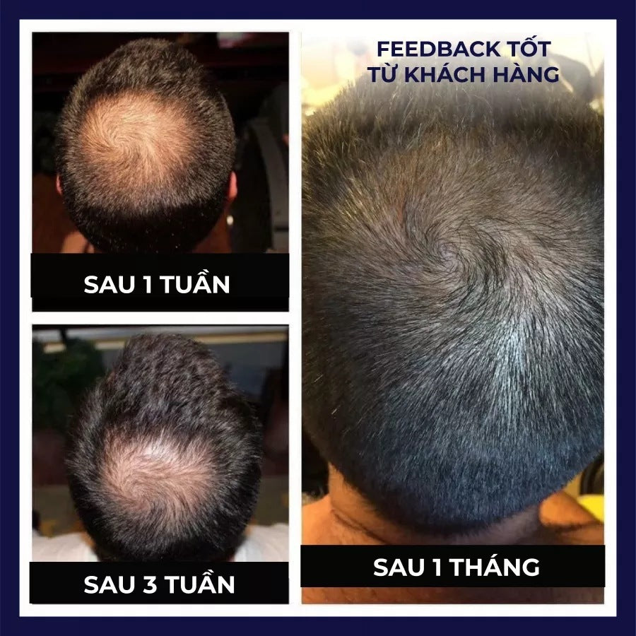 FEG Hair Growth Spray