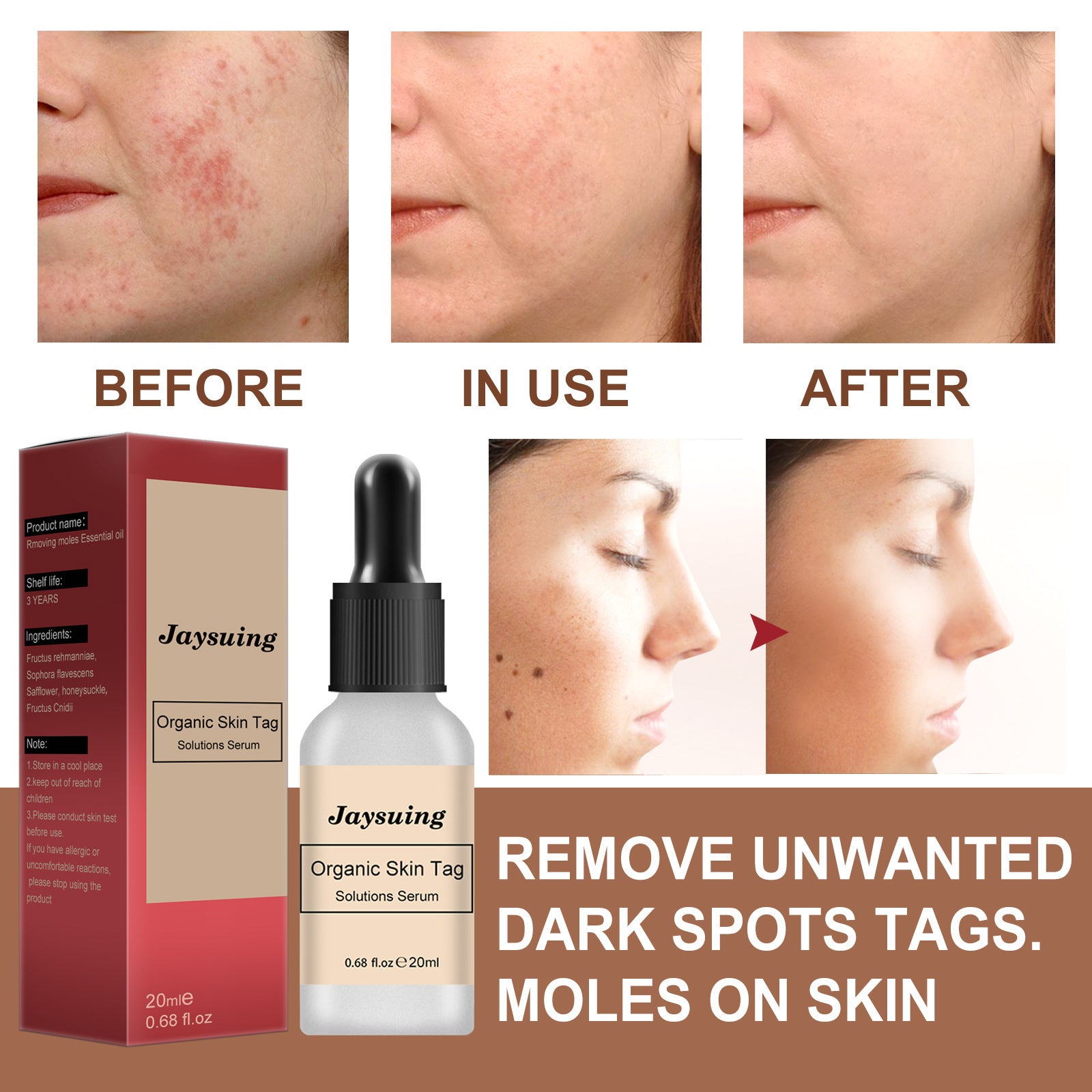NATURAL SPOTS FREE SERUM
