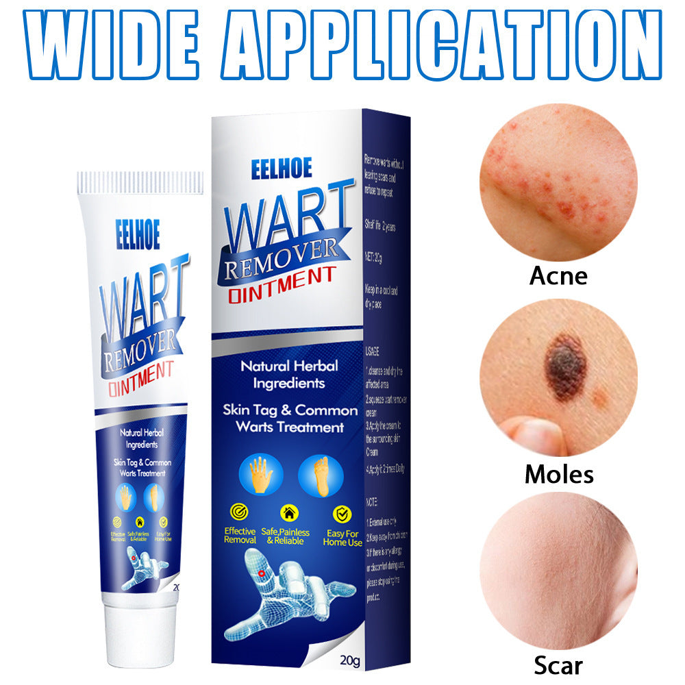 Wartaway Natural Skin Tag & Mole Remover