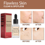 NATURAL SPOTS FREE SERUM