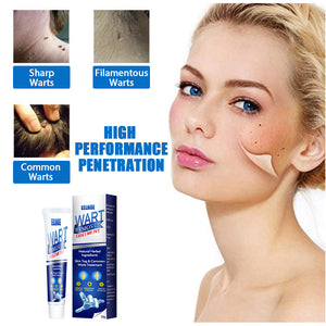 Wartaway Natural Skin Tag & Mole Remover